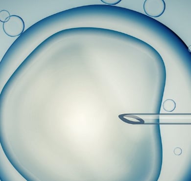 IVF IVF